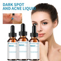 Retinol Serum Anti-Arrugas Facial